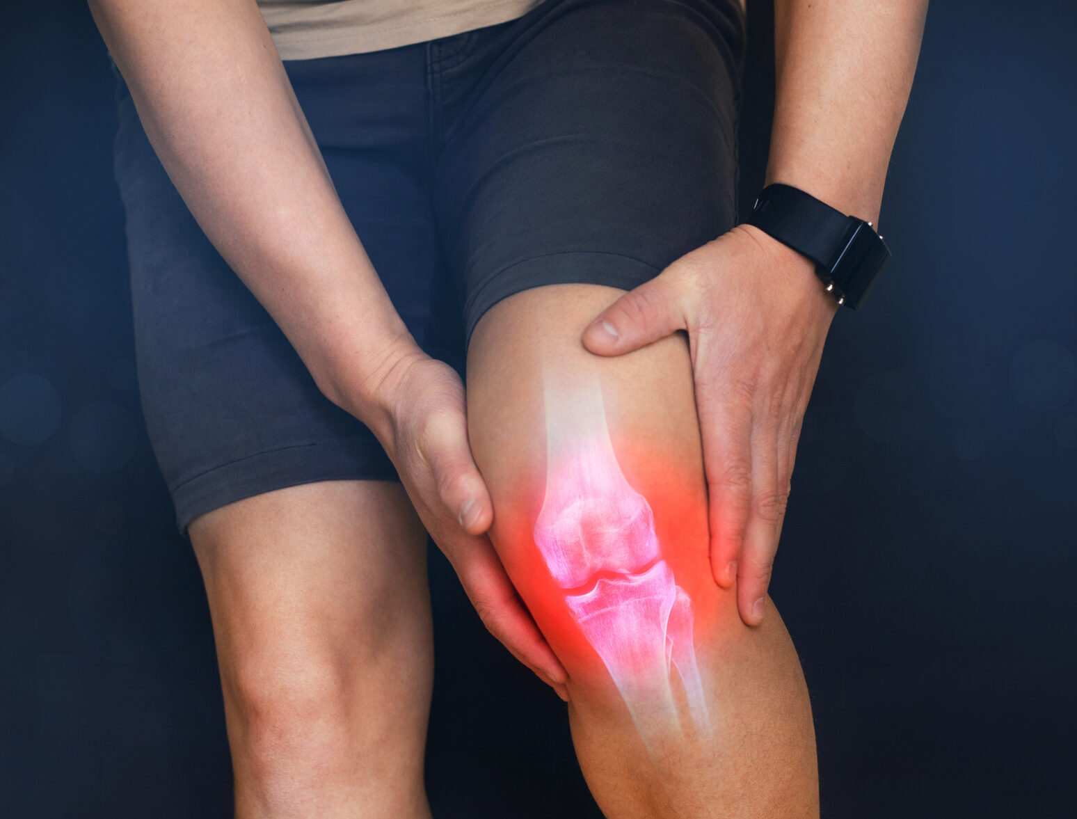 Risonanza magnetica ginocchio