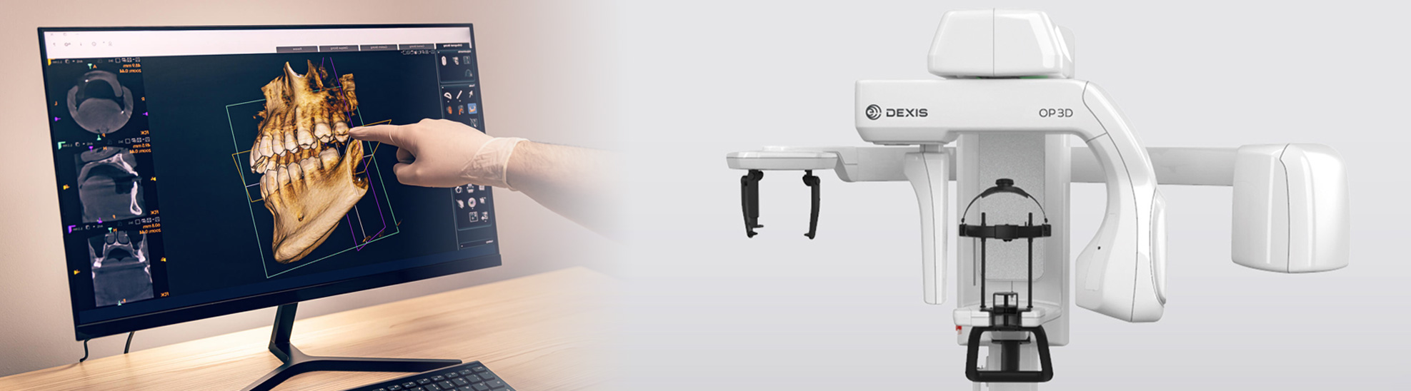 dentalscan tac dentale